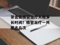 牙齿做根管治疗大概多长时间？根管治疗一共要去几次