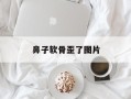 鼻子软骨歪了图片